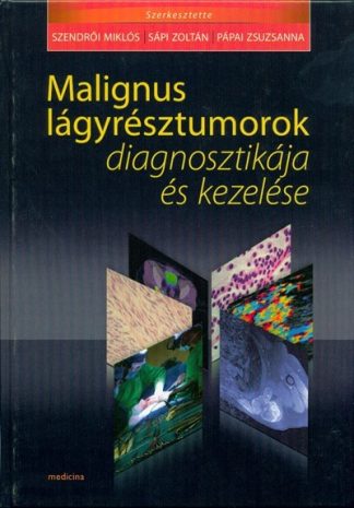 Szendrői Miklós - Malignus lágyrésztumorok diagnosztikája és kezelése